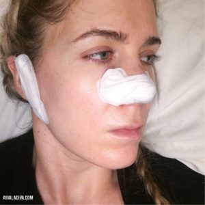 Let's Talk: Skin Cancer