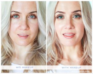 SKIN CANCER: 3 things I wish I knew